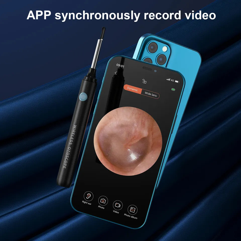 FindB Pro 5MP Home Use Baby Wireless Ear Cleaner with Camera